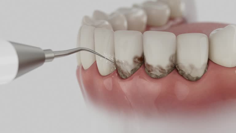Trusted Invisalign Clear Aligners service in Hampton, GA - Dentist Open Now